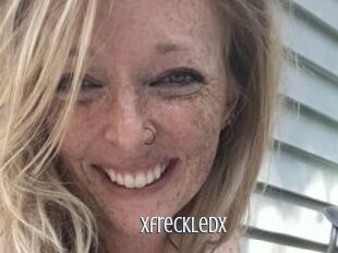 Xfreckledx